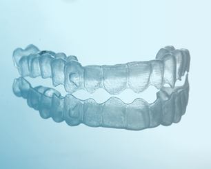 Invisalign ortodonzia invisibile